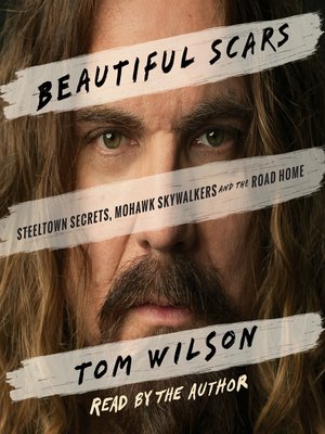 cover image of Beautiful Scars